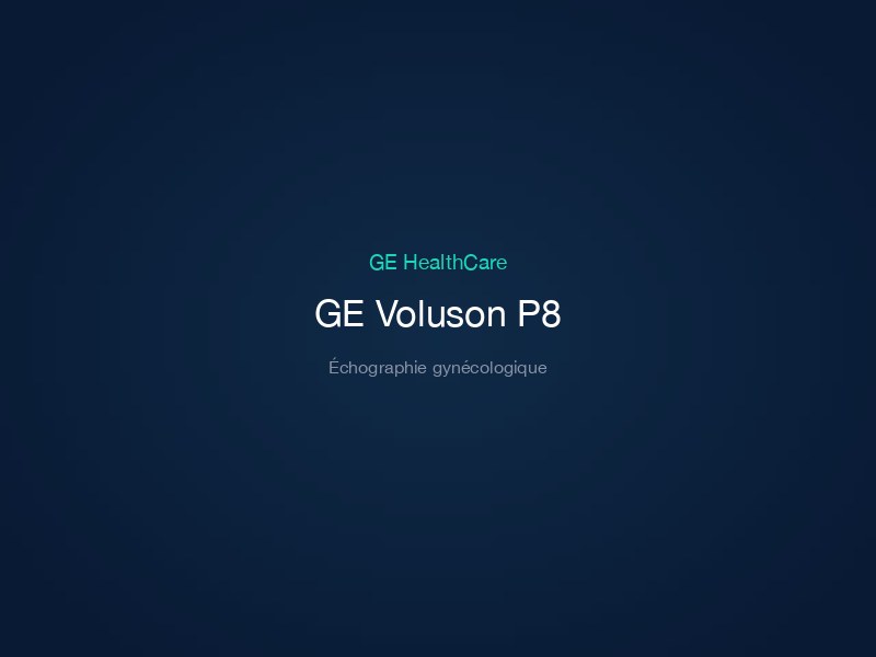 GE Voluson P8